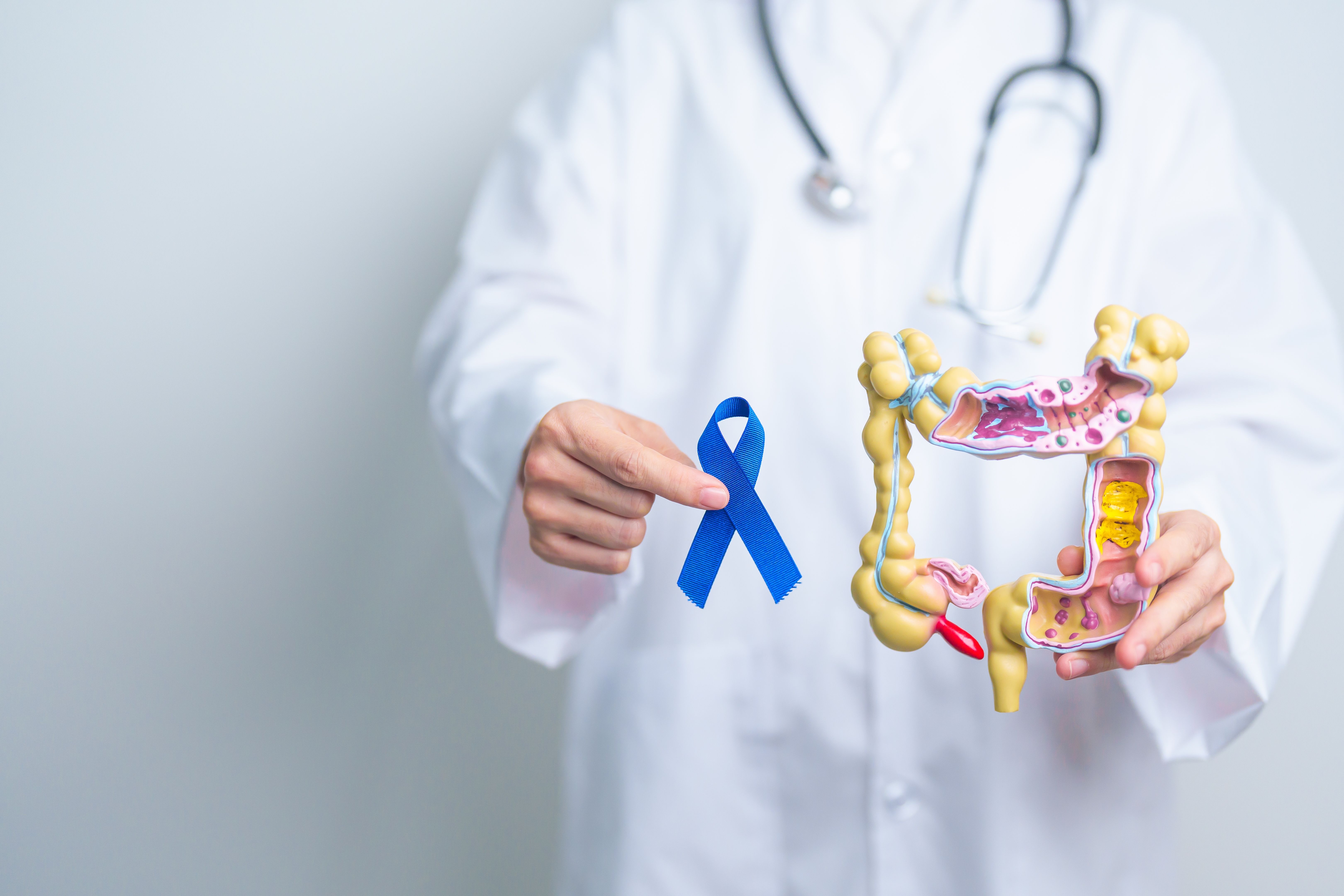 Quiz cancer colorectal