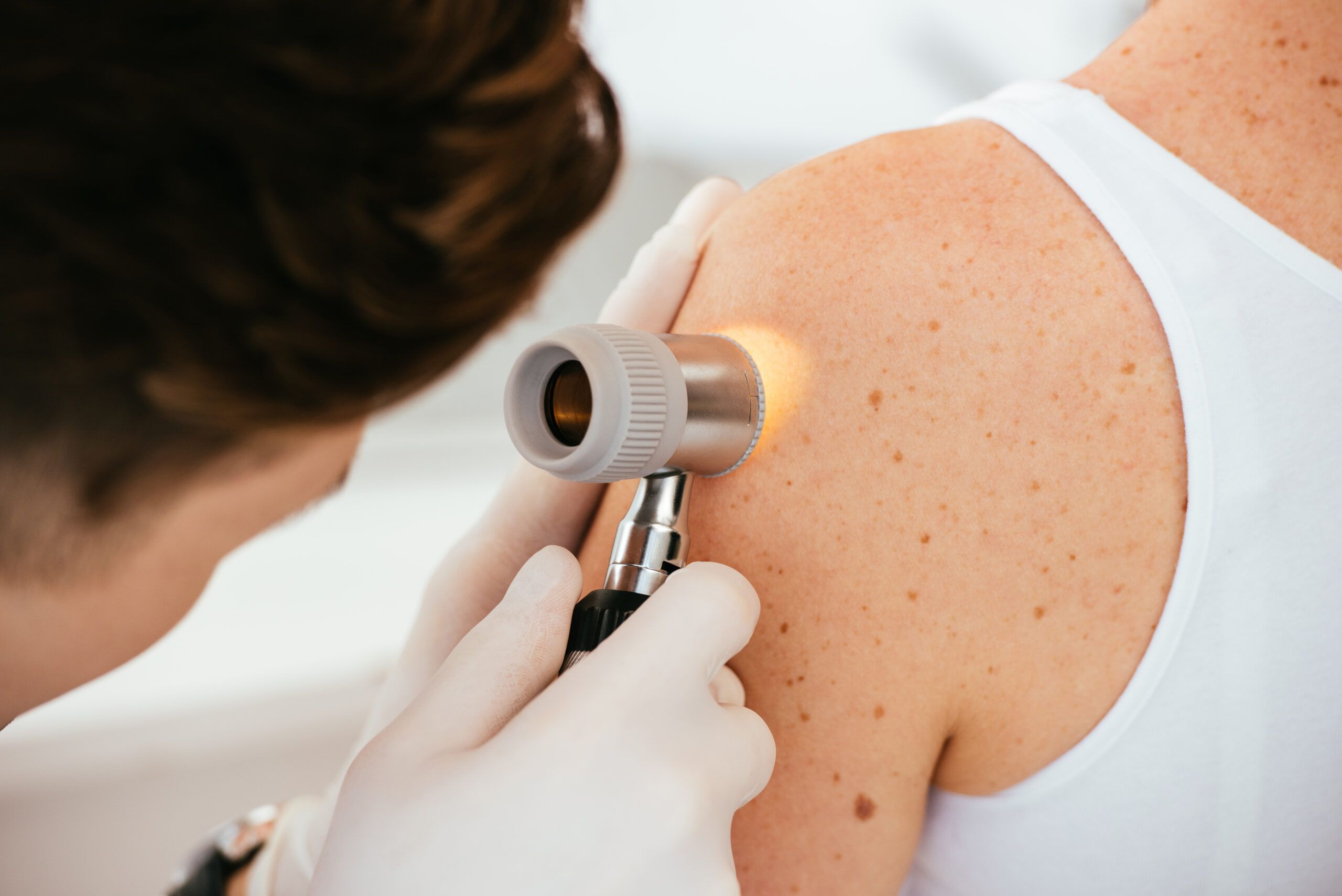 Quiz dermatologie