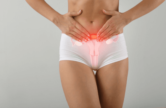 Quiz Endométriose - cas clinique