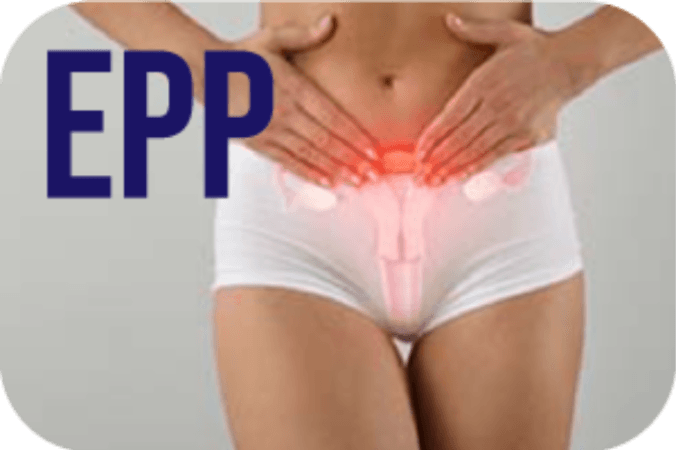 Diagnostic précoce et parcours de soins de l’endométriose : évaluation des pratiques professionnelles pour les gynécologues